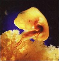 op de foto is een embryo te zien dat vast zit aan een placenta. 